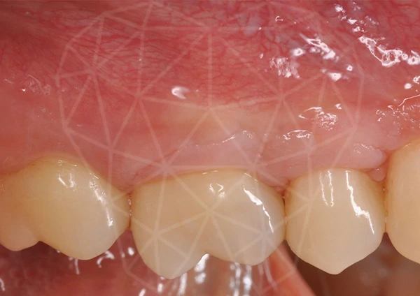 After-Parodontologia 39 anni