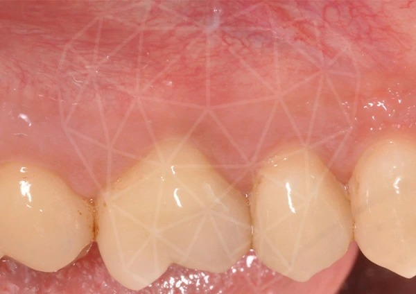 Before-Parodontologia 39 anni