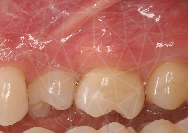 After-Parodontologia 48 anni