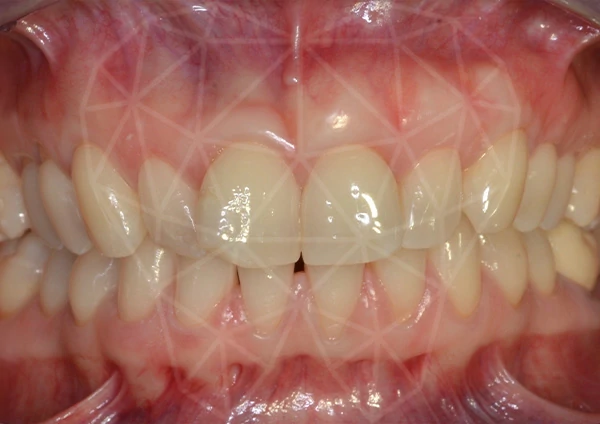 After-Parodontologia