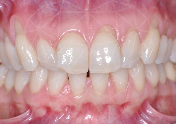 Before-Parodontologia