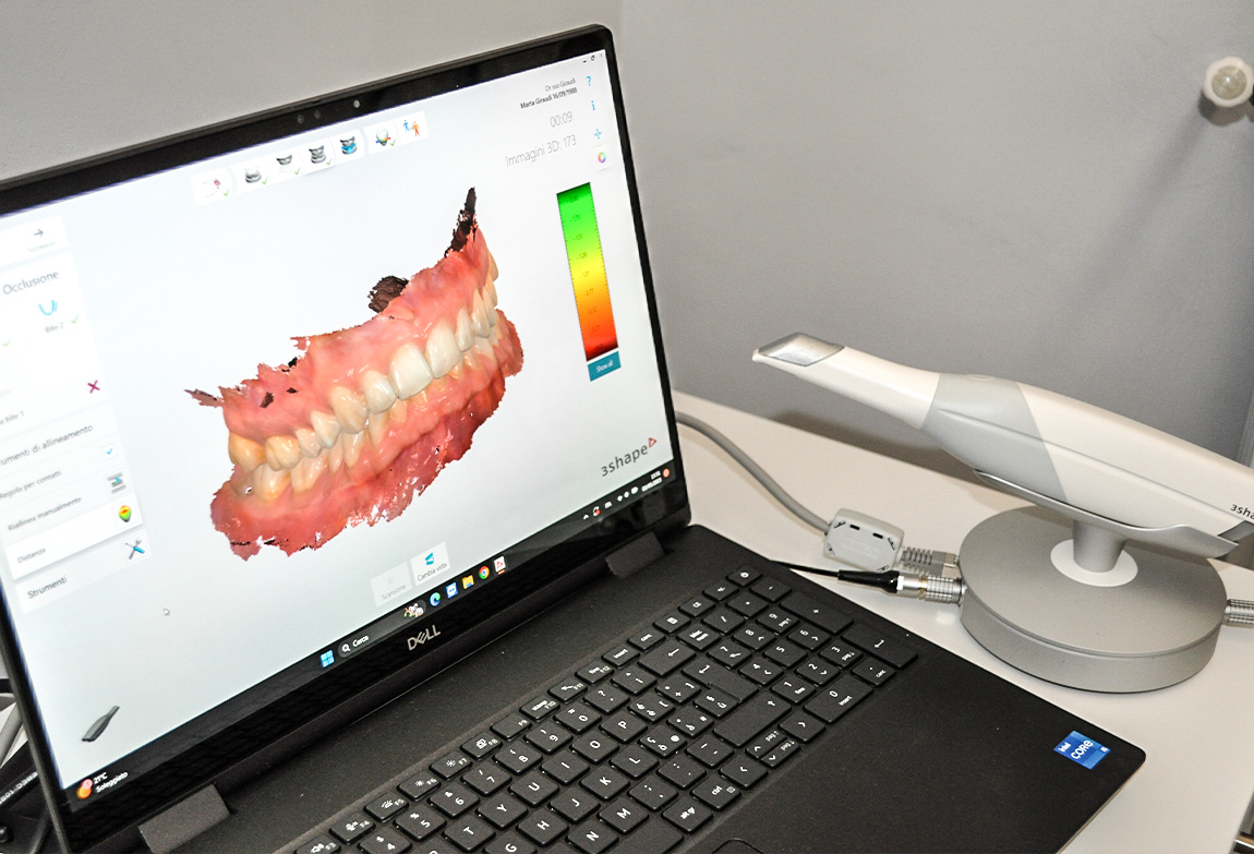 Impronte Dentali a Fossano