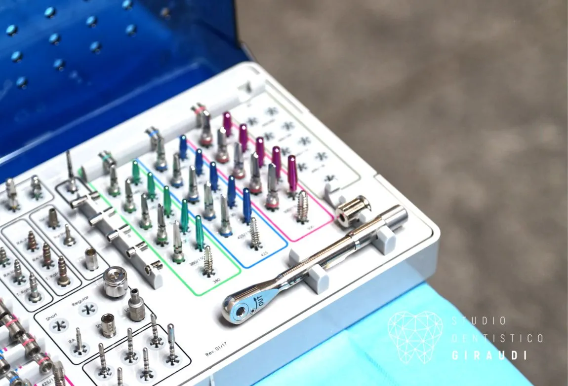 impianti dentali fossano