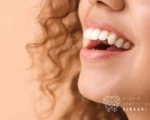 macchie sui denti